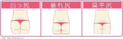 骨盤の歪みについての話です | 大泉学園北口カイロプラクティック整体院